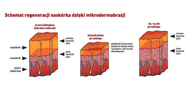 mikro1